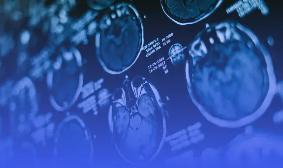 ListPlaceholder1 (1)